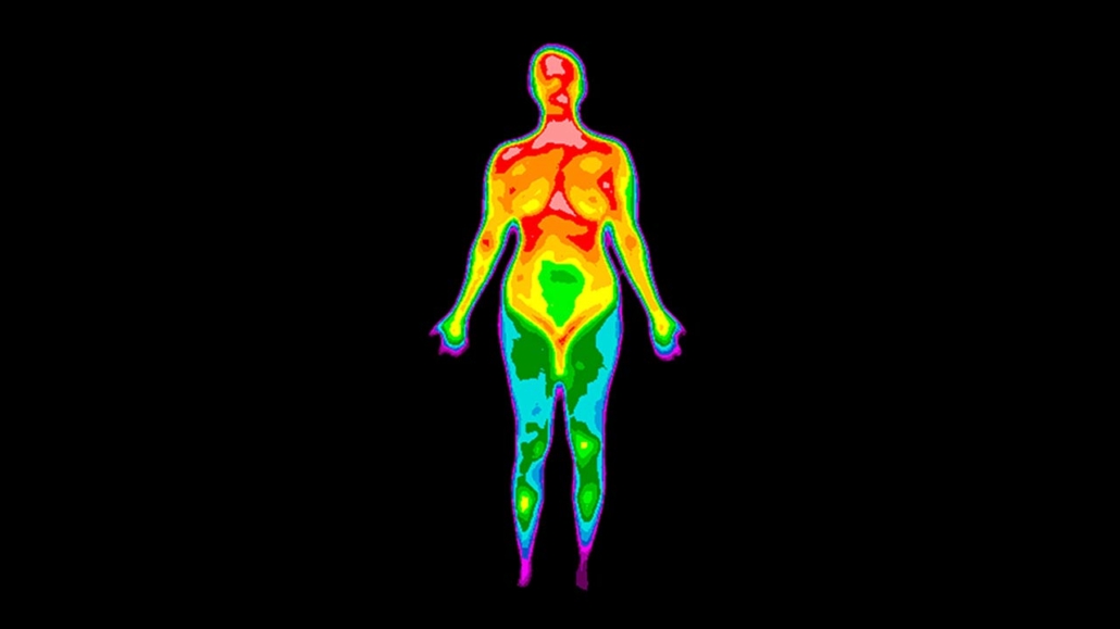Thermographic image of front of whole body of a woman with photo showing different temperatures in a range of colors